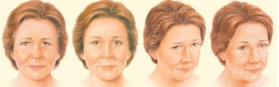 plastic surgery cyprus_52.jpg